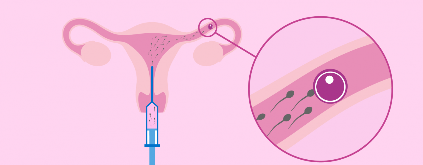 gallery/que-es-la-inseminacion-artificial