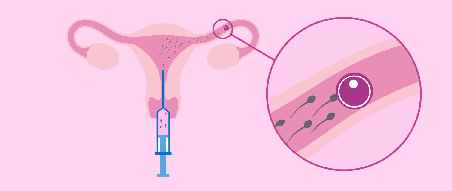 gallery/que-es-la-inseminacion-artificial
