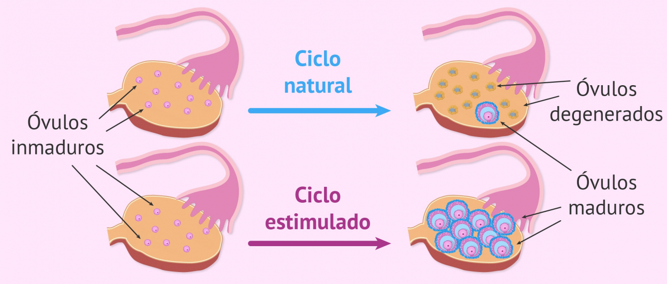 gallery/medicamentos-estimulacion-ovarica-foliculos